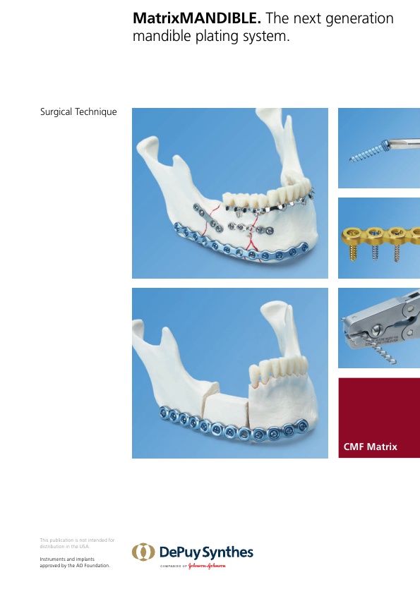 MATRIXMANDIBLE