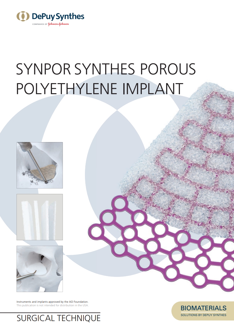SYNPOR